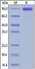 Human IL-31 RA, Fc Tag on SDS-PAGE under reducing (R) condition. The gel was stained overnight with Coomassie Blue. The purity of the protein is greater than 95%.