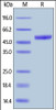 Mouse PVRIG, Fc Tag on SDS-PAGE under reducing (R) condition. The gel was stained overnight with Coomassie Blue. The purity of the protein is greater than 95%.