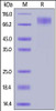 Rabbit M-CSF R, His Tag on SDS-PAGE under reducing (R) condition. The gel was stained overnight with Coomassie Blue. The purity of the protein is greater than 90%.