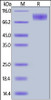 Canine M-CSF R, His Tag on SDS-PAGE under reducing (R) condition. The gel was stained overnight with Coomassie Blue. The purity of the protein is greater than 95%.