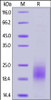 Human PSCA, His Tag on SDS-PAGE under reducing (R) condition. The gel was stained overnight with Coomassie Blue. The purity of the protein is greater than 90%.