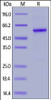 Human Properdin, His Tag on SDS-PAGE under reducing (R) condition. The gel was stained overnight with Coomassie Blue. The purity of the protein is greater than 90%.