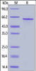 Human Tau-441, His Tag on SDS-PAGE under reducing (R) condition. The gel was stained overnight with Coomassie Blue. The purity of the protein is greater than 90%.