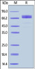 Rhesus macaque GHR, Fc Tag on SDS-PAGE under reducing (R) condition. The gel was stained overnight with Coomassie Blue. The purity of the protein is greater than 90%.