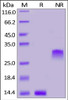 Human PDGF-BB, Tag Free on SDS-PAGE under reducing (R) and non-reducing (NR) conditions. The gel was stained overnight with Coomassie Blue. The purity of the protein is greater than 90%.