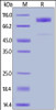 Human B7-H7, Fc Tag on SDS-PAGE under reducing (R) condition. The gel was stained overnight with Coomassie Blue. The purity of the protein is greater than 90%.