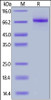 Human IL-12 R beta 1, His Tag on SDS-PAGE under reducing (R) condition. The gel was stained overnight with Coomassie Blue. The purity of the protein is greater than 90%.