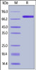 Human GM-CSF R alpha, Fc Tag on SDS-PAGE under reducing (R) condition. The gel was stained overnight with Coomassie Blue. The purity of the protein is greater than 95%.