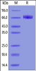 Human IL-4 R alpha, Fc Tag on SDS-PAGE under reducing (R) condition. The gel was stained overnight with Coomassie Blue. The purity of the protein is greater than 95%.