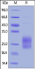 Human ICOS (C136S, C137S) , His Tag on SDS-PAGE under reducing (R) condition. The gel was stained overnight with Coomassie Blue. The purity of the protein is greater than 85%.