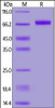 Human CD39, His Tag on SDS-PAGE under reducing (R) condition. The gel was stained overnight with Coomassie Blue. The purity of the protein is greater than 95%.