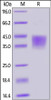 Human / Cynomolgus / Rhesus macaque CD28, His Tag on SDS-PAGE under reducing (R) condition. The gel was stained overnight with Coomassie Blue. The purity of the protein is greater than 90%.
