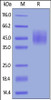 Cynomolgus DNAM-1, His Tag on SDS-PAGE under reducing (R) condition. The gel was stained overnight with Coomassie Blue. The purity of the protein is greater than 90%.