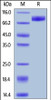 Human IL-1 Rrp2, Fc Tag on SDS-PAGE under reducing (R) condition. The gel was stained overnight with Coomassie Blue. The purity of the protein is greater than 95%.