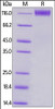 Human CD96, Mouse IgG2a Fc Tag, low endotoxin on SDS-PAGE under reducing (R) condition. The gel was stained overnight with Coomassie Blue. The purity of the protein is greater than 90%.