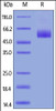 Human IL-1 Rrp2, His Tag on SDS-PAGE under reducing (R) condition. The gel was stained overnight with Coomassie Blue. The purity of the protein is greater than 90%.