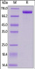 Cynomolgus Her2, His Tag on SDS-PAGE under reducing (R) condition. The gel was stained overnight with Coomassie Blue. The purity of the protein is greater than 95%.