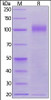 Rhesus macaque Siglec-2, His Tag on SDS-PAGE under reducing (R) condition. The gel was stained overnight with Coomassie Blue. The purity of the protein is greater than 95%.