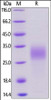 Mouse PLGF, His Tag on SDS-PAGE under reducing (R) condition. The gel was stained overnight with Coomassie Blue. The purity of the protein is greater than 95%.