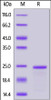 Human SLC1A5, His Tag, TrxA Tag on SDS-PAGE under reducing (R) condition. The gel was stained overnight with Coomassie Blue. The purity of the protein is greater than 90%.