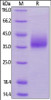 Human NTB-A, His Tag on SDS-PAGE under reducing (R) condition. The gel was stained overnight with Coomassie Blue. The purity of the protein is greater than 95%.