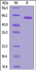 Human DLL3, Fc Tag on SDS-PAGE under reducing (R) condition. The gel was stained overnight with Coomassie Blue. The purity of the protein is greater than 90%.