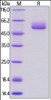 Human Frizzled-2, Fc Tag on SDS-PAGE under reducing (R) condition. The gel was stained overnight with Coomassie Blue. The purity of the protein is greater than 95%.