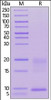 Human TSLP, His Tag on SDS-PAGE under reducing (R) condition. The gel was stained overnight with Coomassie Blue. The purity of the protein is greater than 90%.