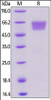 Human TIM-3, Mouse IgG2a Fc Tag, low endotoxin on SDS-PAGE under reducing (R) condition. The gel was stained overnight with Coomassie Blue. The purity of the protein is greater than 95%.