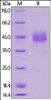 Human TROP-2, His Tag on SDS-PAGE under reducing (R) condition. The gel was stained overnight with Coomassie Blue. The purity of the protein is greater than 95%.