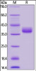 Human CD52, Fc Tag on SDS-PAGE under reducing (R) condition. The gel was stained overnight with Coomassie Blue. The purity of the protein is greater than 95%.