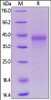 Marmoset OX40, His Tag on SDS-PAGE under reducing (R) condition. The gel was stained overnight with Coomassie Blue. The purity of the protein is greater than 90%.