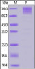 Human CD96, His Tag on SDS-PAGE under reducing (R) condition. The gel was stained overnight with Coomassie Blue. The purity of the protein is greater than 90%.