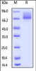 Human IL-7 R alpha, Mouse IgG2a Fc Tag on SDS-PAGE under reducing (R) condition. The gel was stained overnight with Coomassie Blue. The purity of the protein is greater than 90%.