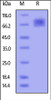 Human ICAM-1, His Tag on SDS-PAGE under reducing (R) condition. The gel was stained overnight with Coomassie Blue. The purity of the protein is greater than 95%.