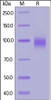 Human EGF R, His Tag on SDS-PAGE under reducing (R) condition. The gel was stained overnight with Coomassie Blue. The purity of the protein is greater than 95%.