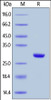 BenzNuclease-DNA-RNA-Nuclease on SDS-PAGE under reducing (R) condition. The gel was stained overnight with Coomassie Blue. The purity of the protein is greater than 95%.