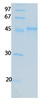 SARS-CoV-2 (COVID-19) ORF7B Recombinant Protein | 20-194