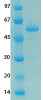 MERS Coronavirus Envelope (HSZ-Cc) Recombinant Protein | 20-198