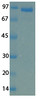 MERS Cornonavirus Envelope (HSZ-Cc) Recombinant Protein | 20-200