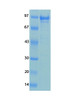 Human Coronavirus OC43 Recombinant Protein | 20-202