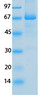 SARS-CoV-2 (COVID-19) Membrane Recombinant Protein | 20-203