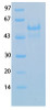 SARS-CoV-2 (COVID-19) Envelope Recombinant Protein | 20-205