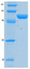 SARS-CoV-2 (COVID-19) NSP9 Recombinant Protein | 20-212