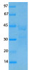 SARS Coronavirus Membrane (HSZ-Cc) Recombinant Protein | 20-221