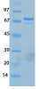 MERS Coronavirus Nucleocapsid (HSZ-Cc) Recombinant Protein | 20-224