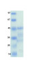 MERS Coronavirus Membrane (HSZ-Cc) Recombinant Protein | 20-225