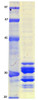 MERS Coronavirus Envelope (HSZ-Cc) Recombinant Protein | 20-226