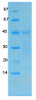 SARS-CoV-2 (COVID-19) Membrane Recombinant Protein | 20-230