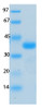 SARS-CoV-2 (COVID-19) ORF9A Recombinant Protein | 20-236